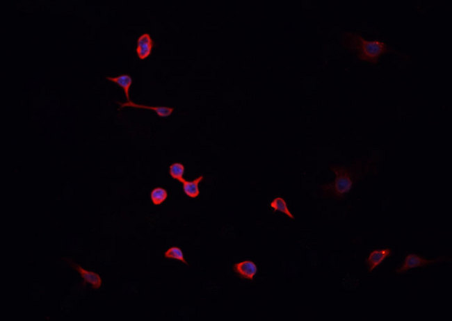 HNRNPA2B1 Antibody - Staining HepG2 cells by IF/ICC. The samples were fixed with PFA and permeabilized in 0.1% Triton X-100, then blocked in 10% serum for 45 min at 25°C. The primary antibody was diluted at 1:200 and incubated with the sample for 1 hour at 37°C. An Alexa Fluor 594 conjugated goat anti-rabbit IgG (H+L) Ab, diluted at 1/600, was used as the secondary antibody.