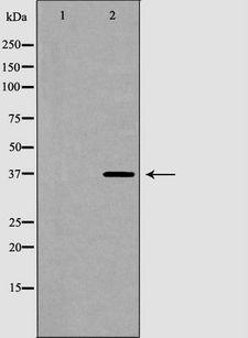 HNRNPA2B1 Antibody - Western blot analysis of extracts of HeLa cells using HNRNPA2B1 antibody. The lane on the left is treated with the antigen-specific peptide.