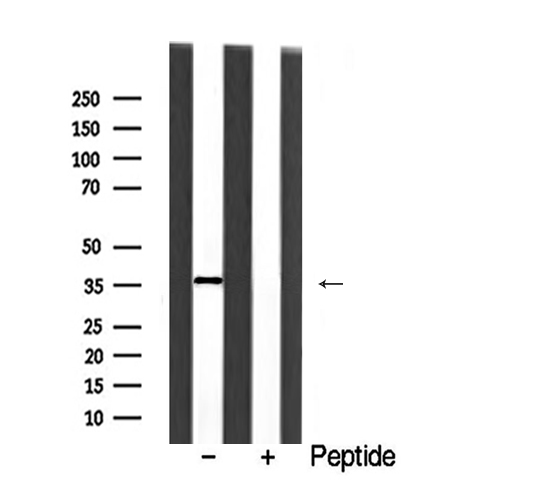 HNRNPA2B1 Antibody - Western blot analysis of extracts of rat spleen cells lines using HNRNPA2B1 antibody.