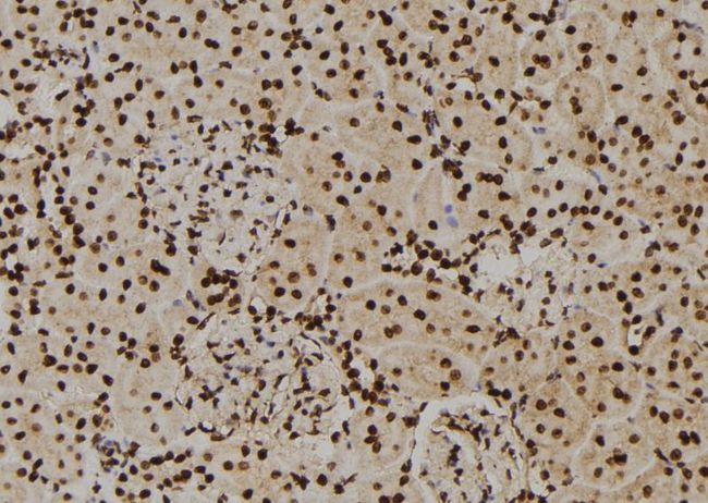HNRNPA2B1 Antibody - 1:100 staining rat kidney tissue by IHC-P. The sample was formaldehyde fixed and a heat mediated antigen retrieval step in citrate buffer was performed. The sample was then blocked and incubated with the antibody for 1.5 hours at 22°C. An HRP conjugated goat anti-rabbit antibody was used as the secondary.