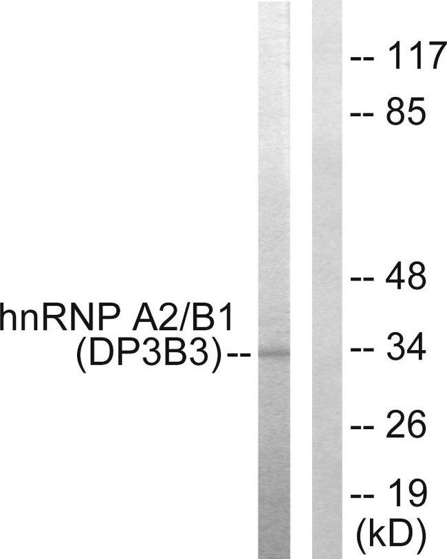 HNRNPA2B1 Antibody - Western blot analysis of extracts from HepG2 cells, using hnRNP A2/B1 antibody.