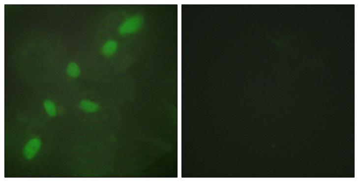 HNRNPA2B1 Antibody - Peptide - + Immunofluorescence analysis of HeLa cells, using hnRNP A2/B1 antibody.