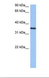 HNRNPA2B1 Antibody - Jurkat cell lysate. Antibody concentration: 0.5 ug/ml. Gel concentration: 12%.  This image was taken for the unconjugated form of this product. Other forms have not been tested.