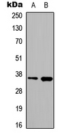 HNRNPA2B1 Antibody - Western blot analysis of hnRNP A2/B1 expression in HeLa (A); PC3 (B) whole cell lysates.