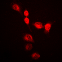 HNRNPA2B1 Antibody - Immunofluorescent analysis of hnRNP A2/B1 staining in HeLa cells. Formalin-fixed cells were permeabilized with 0.1% Triton X-100 in TBS for 5-10 minutes and blocked with 3% BSA-PBS for 30 minutes at room temperature. Cells were probed with the primary antibody in 3% BSA-PBS and incubated overnight at 4 deg C in a humidified chamber. Cells were washed with PBST and incubated with a DyLight 594-conjugated secondary antibody (red) in PBS at room temperature in the dark. DAPI was used to stain the cell nuclei (blue).