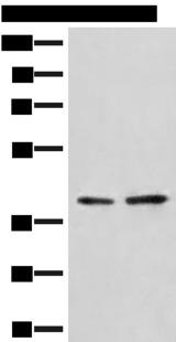 HNRNPA3 / HnRNP A3 Antibody - Western blot analysis of A172 and LO2 cell lysates  using HNRNPA3 Polyclonal Antibody at dilution of 1:500