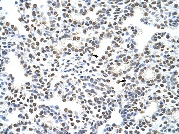 HNRNPA3 / HnRNP A3 Antibody - HNRNPA3 / HNRPA3 antibody ARP41195_T100-NP_919223-HNRPA3 (heterogeneous nuclear ribonucleoprotein A3) Antibody was used in IHC to stain formalin-fixed, paraffin-embedded human lung.  This image was taken for the unconjugated form of this product. Other forms have not been tested.