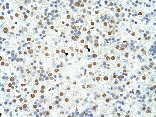 HNRNPA3 / HnRNP A3 Antibody - HNRNPA3 / HNRPA3 antibody ARP41196_T100-NP_919223-HNRPA3 (heterogeneous nuclear ribonucleoprotein A3) Antibody was used in IHC to stain formalin-fixed, paraffin-embedded human liver.  This image was taken for the unconjugated form of this product. Other forms have not been tested.