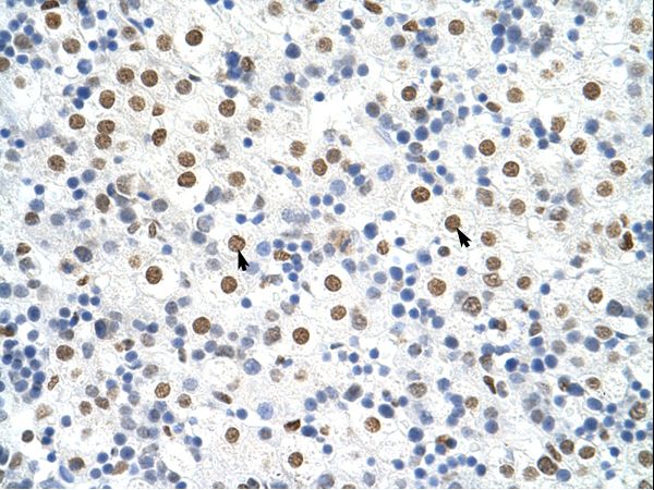 HNRNPA3 / HnRNP A3 Antibody - HNRNPA3 / HNRPA3 antibody ARP41195_T100-NP_919223-HNRPA3 (heterogeneous nuclear ribonucleoprotein A3) Antibody was used in IHC to stain formalin-fixed, paraffin-embedded human liver.  This image was taken for the unconjugated form of this product. Other forms have not been tested.