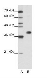 HNRNPA3 / HnRNP A3 Antibody - A: Marker, B: Jurkat Cell Lysate.  This image was taken for the unconjugated form of this product. Other forms have not been tested.