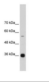 HNRNPAB Antibody - Daudi Cell Lysate.  This image was taken for the unconjugated form of this product. Other forms have not been tested.