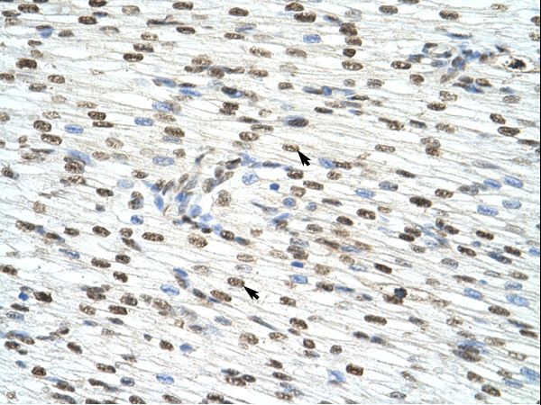 HNRNPAB Antibody - HNRNPAB / HNRPAB antibody ARP41036_T100-NP_112556-HNRPAB (heterogeneous nuclear ribonucleoprotein A/B) Antibody was used in IHC to stain formalin-fixed, paraffin-embedded human heart.  This image was taken for the unconjugated form of this product. Other forms have not been tested.