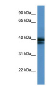 HNRNPAB Antibody - HNRNPAB / HNRPAB antibody Western blot of COLO205 cell lysate. This image was taken for the unconjugated form of this product. Other forms have not been tested.