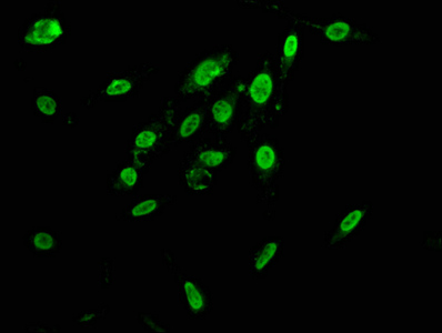 HNRNPAB Antibody - Immunofluorescence staining of Hela cells at a dilution of 1:166, counter-stained with DAPI. The cells were fixed in 4% formaldehyde, permeabilized using 0.2% Triton X-100 and blocked in 10% normal Goat Serum. The cells were then incubated with the antibody overnight at 4°C.The secondary antibody was Alexa Fluor 488-congugated AffiniPure Goat Anti-Rabbit IgG (H+L) .