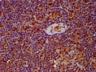 HNRNPAB Antibody - Immunohistochemistry image at a dilution of 1:500 and staining in paraffin-embedded human lymph node tissue performed on a Leica BondTM system. After dewaxing and hydration, antigen retrieval was mediated by high pressure in a citrate buffer (pH 6.0) . Section was blocked with 10% normal goat serum 30min at RT. Then primary antibody (1% BSA) was incubated at 4 °C overnight. The primary is detected by a biotinylated secondary antibody and visualized using an HRP conjugated SP system.