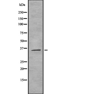 HNRNPAB Antibody - Western blot analysis of ROAA expression in HEK293 cells. The lane on the left is treated with the antigen-specific peptide.