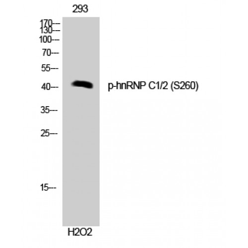 HNRNPC / HNRNP C Antibody - Western blot of Phospho-hnRNP C1/2 (S260) antibody