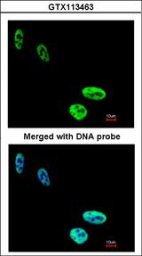 HNRNPC / HNRNP C Antibody - Immunofluorescence of paraformaldehyde-fixed HeLa using hnRNP C1/C2 antibody at 1:200 dilution.