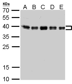 HNRNPC / HNRNP C Antibody - hnRNP C1/C2 antibody detects HNRNPC protein by Western blot analysis. A. 30 ug Neuro2A whole cell lysate/extract. B. 30 ug NIH-3T3 whole cell lysate/extract. C. 30 ug BCL-1 whole cell lysate/extract. D. 30 ug Raw264.7 whole cell lysate/extract. E. 30 ug C2C12 whole cell lysate/extract. 12 % SDS-PAGE. hnRNP C1/C2 antibody dilution:1:1000