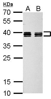 HNRNPC / HNRNP C Antibody - hnRNP C1/C2 antibody detects HNRNPC protein by Western blot analysis. A. 30 ug PC-12 whole cell lysate/extract. B. 30 ug Rat2 whole cell lysate/extract. 12 % SDS-PAGE. hnRNP C1/C2 antibody dilution:1:1000