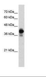 HNRNPC / HNRNP C Antibody - Jurkat Cell Lysate.  This image was taken for the unconjugated form of this product. Other forms have not been tested.