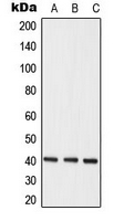 HNRNPC / HNRNP C Antibody - Western blot analysis of hNRNP C expression in MCF7 (A); K562 (B); HeLa (C) whole cell lysates.