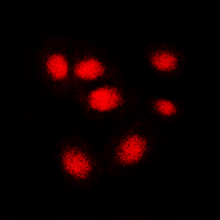 HNRNPC / HNRNP C Antibody - Immunofluorescent analysis of hNRNP C staining in MCF7 cells. Formalin-fixed cells were permeabilized with 0.1% Triton X-100 in TBS for 5-10 minutes and blocked with 3% BSA-PBS for 30 minutes at room temperature. Cells were probed with the primary antibody in 3% BSA-PBS and incubated overnight at 4 C in a humidified chamber. Cells were washed with PBST and incubated with a DyLight 594-conjugated secondary antibody (red) in PBS at room temperature in the dark. DAPI was used to stain the cell nuclei (blue).