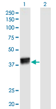 HNRNPC / HNRNP C Antibody - Western Blot analysis of HNRNPC expression in transfected 293T cell line by HNRNPC monoclonal antibody (M02), clone 4E8.Lane 1: HNRNPC transfected lysate (Predicted MW: 32.34 KDa).Lane 2: Non-transfected lysate.