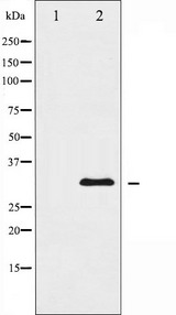 HNRNPC / HNRNP C Antibody - Western blot analysis of hnRNP C1/C2 antibody expression in 293 cells lysates. The lane on the left is treated with the antigen-specific peptide.