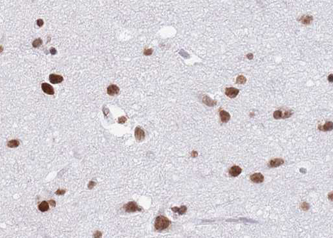 HNRNPC / HNRNP C Antibody - 1:100 staining human brain tissue by IHC-P. The tissue was formaldehyde fixed and a heat mediated antigen retrieval step in citrate buffer was performed. The tissue was then blocked and incubated with the antibody for 1.5 hours at 22°C. An HRP conjugated goat anti-rabbit antibody was used as the secondary.