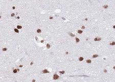 HNRNPC / HNRNP C Antibody - 1:100 staining human brain tissue by IHC-P. The tissue was formaldehyde fixed and a heat mediated antigen retrieval step in citrate buffer was performed. The tissue was then blocked and incubated with the antibody for 1.5 hours at 22°C. An HRP conjugated goat anti-rabbit antibody was used as the secondary.
