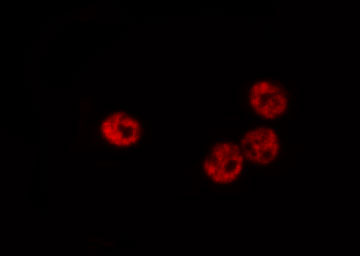 HNRNPC / HNRNP C Antibody - Staining 293 cells by IF/ICC. The samples were fixed with PFA and permeabilized in 0.1% Triton X-100, then blocked in 10% serum for 45 min at 25°C. The primary antibody was diluted at 1:200 and incubated with the sample for 1 hour at 37°C. An Alexa Fluor 594 conjugated goat anti-rabbit IgG (H+L) Ab, diluted at 1/600, was used as the secondary antibody.