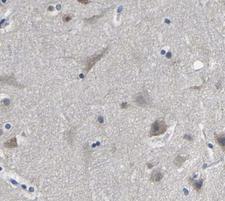 HNRNPC / HNRNP C Antibody - 1:200 staining human brain tissue by IHC-P. The tissue was formaldehyde fixed and a heat mediated antigen retrieval step in citrate buffer was performed. The tissue was then blocked and incubated with the antibody for 1.5 hours at 22°C. An HRP conjugated goat anti-rabbit antibody was used as the secondary.