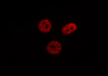 HNRNPC / HNRNP C Antibody - Staining 293 cells by IF/ICC. The samples were fixed with PFA and permeabilized in 0.1% Triton X-100, then blocked in 10% serum for 45 min at 25°C. The primary antibody was diluted at 1:200 and incubated with the sample for 1 hour at 37°C. An Alexa Fluor 594 conjugated goat anti-rabbit IgG (H+L) Ab, diluted at 1/600, was used as the secondary antibody.