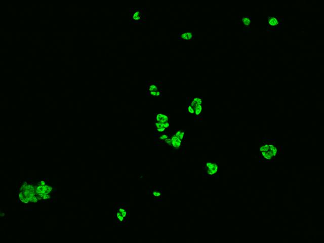 HNRNPC / HNRNP C Antibody - Immunofluorescence staining of HNRNPC in HEK293 cells. Cells were fixed with 4% PFA, permeabilzed with 0.1% Triton X-100 in PBS, blocked with 10% serum, and incubated with rabbit anti-Human HNRNPC polyclonal antibody (dilution ratio 1:200) at 4°C overnight. Then cells were stained with the Alexa Fluor 488-conjugated Goat Anti-rabbit IgG secondary antibody (green). Positive staining was localized to Nucleus.