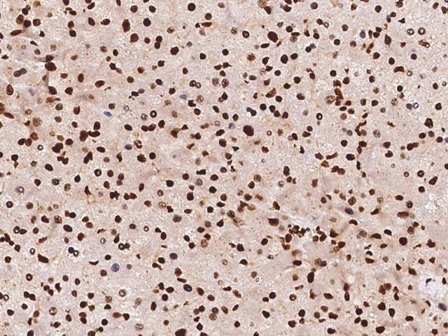HNRNPC / HNRNP C Antibody - Immunochemical staining of human HNRNPC in human liver with rabbit polyclonal antibody at 1:100 dilution, formalin-fixed paraffin embedded sections.