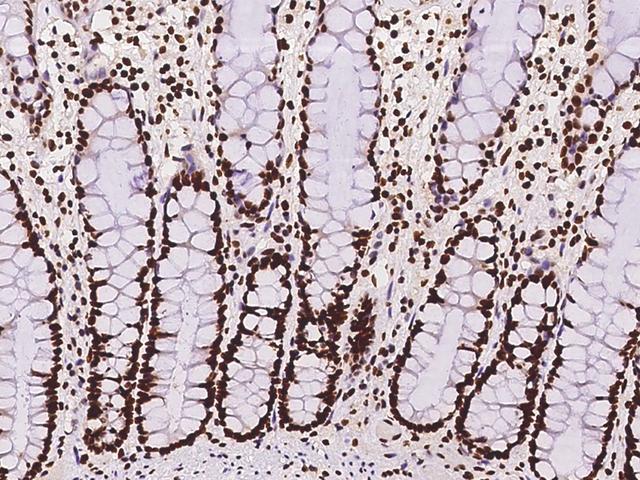 HNRNPC / HNRNP C Antibody - Immunochemical staining of human HNRNPC in human rectum with rabbit polyclonal antibody at 1:100 dilution, formalin-fixed paraffin embedded sections.