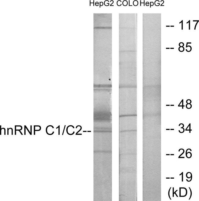 HNRNPC / HNRNP C Antibody - Western blot analysis of extracts from HepG2 cells and COLO205 cells, using hnRNP C1/C2 antibody.