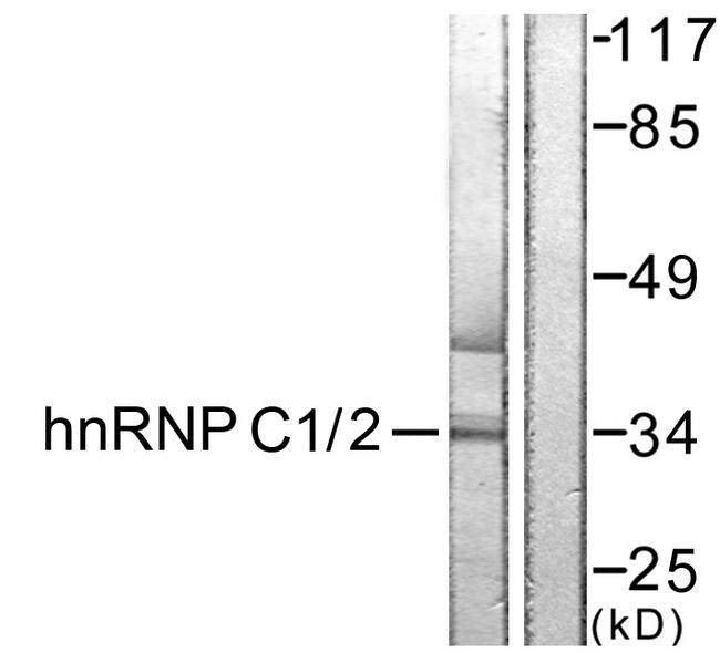 HNRNPC / HNRNP C Antibody - Western blot analysis of extracts from HuvEc cells, treated with EGF (200ng/ml, 5mins), using hnRNP C1/2 (Ab-260) antibody.