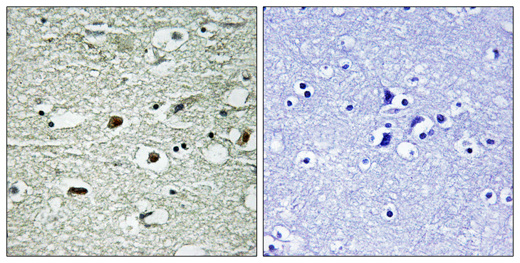 HNRNPC / HNRNP C Antibody - Immunohistochemistry analysis of paraffin-embedded human brain, using hnRNP C1/2 (Phospho-Ser260) Antibody. The picture on the right is blocked with the phospho peptide.