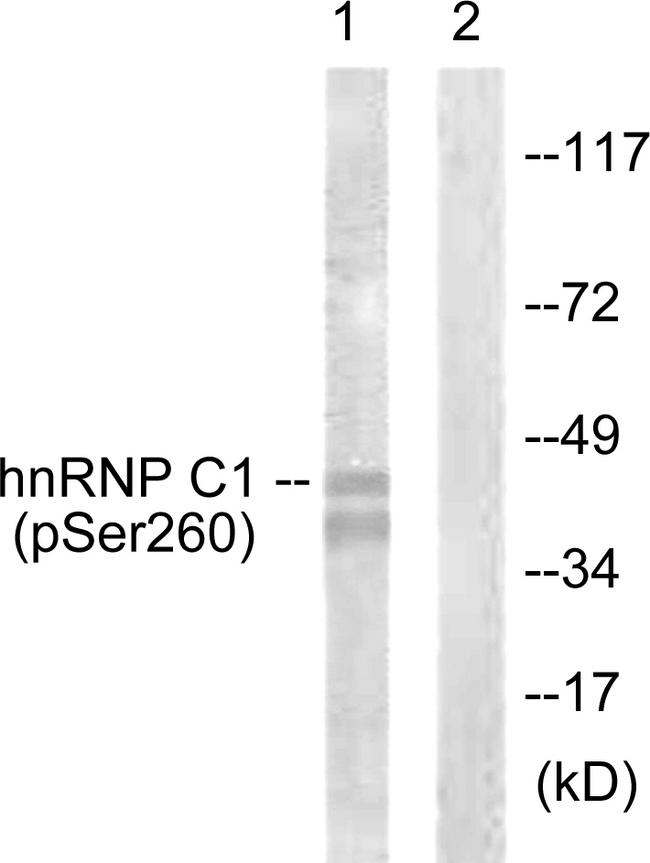 HNRNPC / HNRNP C Antibody - Western blot analysis of lysates from 293 cells treated with H2O2 100uM 15', using hnRNP C1/2 (Phospho-Ser260) Antibody. The lane on the right is blocked with the phospho peptide.