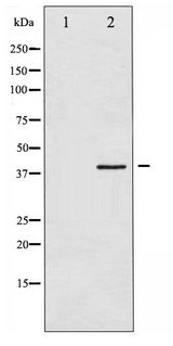 HNRNPC / HNRNP C Antibody - Western blot of hnRNP C1/2 phosphorylation expression in H2O2 treated 293 whole cell lysates,The lane on the left is treated with the antigen-specific peptide.