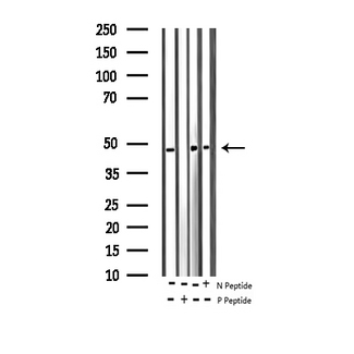 HNRNPC / HNRNP C Antibody - Western blot analysis of Phospho-hnRNP C1/2 (Ser260) expression in various lysates