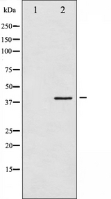 HNRNPC / HNRNP C Antibody - Western blot analysis of hnRNP C1/2 phosphorylation expression in H2O2 treated 293 whole cells lysates. The lane on the left is treated with the antigen-specific peptide.