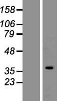 HNRNPC / HNRNP C Protein - Western validation with an anti-DDK antibody * L: Control HEK293 lysate R: Over-expression lysate