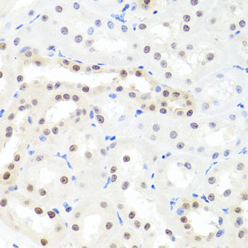 HNRNPCL1 Antibody - Immunohistochemistry of paraffin-embedded rat kidney tissue.