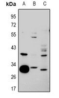 HNRNPCL1 Antibody - Western blot analysis of hnRNP CL1 expression in A549 (A), HEK293T (B), MEF (C) whole cell lysates.