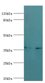 HNRNPD / AUF1 Antibody - Western blot. All lanes: Heterogeneous nuclear ribonucleoprotein D0 antibody at 4 ug/ml. Lane 1: HeLa whole cell lysate. Lane 2: 293T whole cell lysate. Secondary antibody: Goat polyclonal to rabbit at 1:10000 dilution. Predicted band size: 38 kDa. Observed band size: 38 kDa.