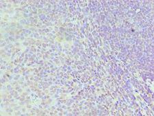 HNRNPD / AUF1 Antibody - Immunohistochemistry of paraffin-embedded human tonsil using antibody at 1:100 dilution.