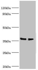 HNRNPD / AUF1 Antibody - Western blot All lanes: HNRNPD antibody at 4µg/ml Lane 1: Hela whole cell lysate Lane 2: 293T whole cell lysate Secondary Goat polyclonal to rabbit IgG at 1/10000 dilution Predicted band size: 39, 37, 33, 31 kDa Observed band size: 39 kDa